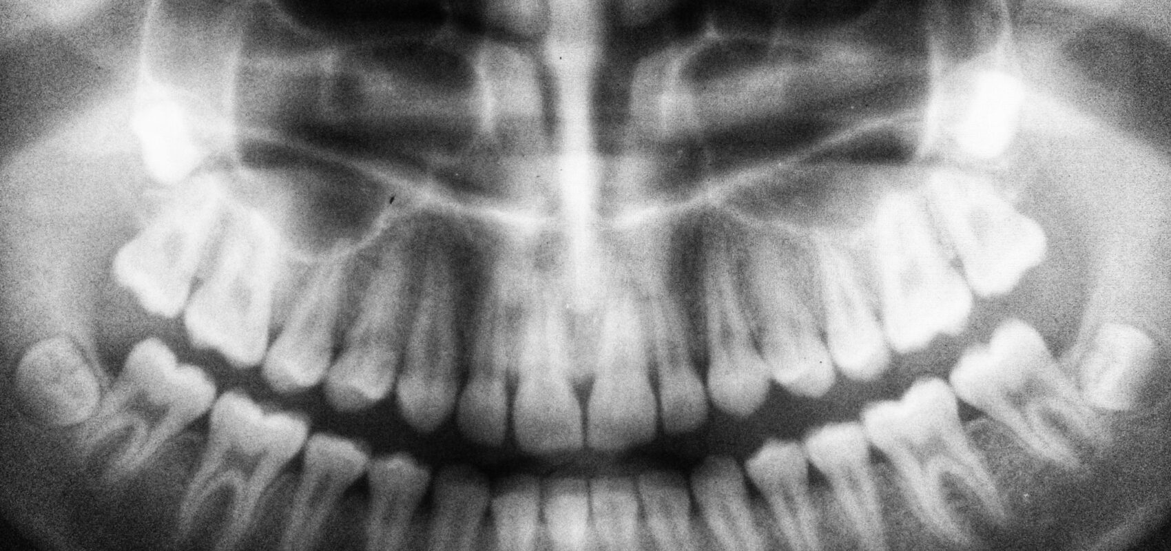 Free Dental Clinic